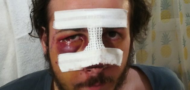 Thomas, grièvement blessé par la police : l’histoire d’un classement sans suite
