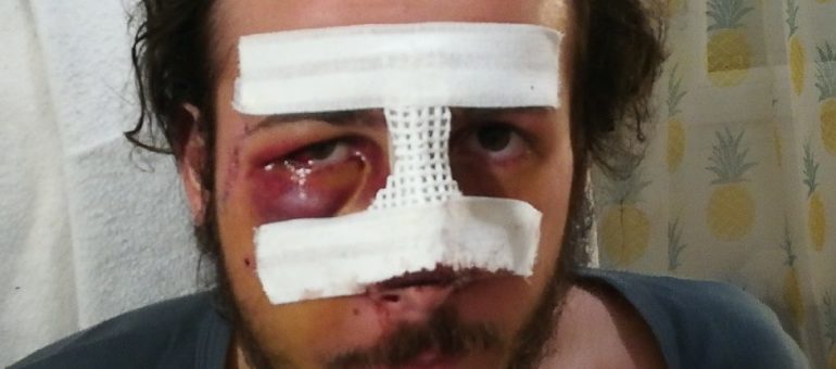 Thomas, grièvement blessé par la police pendant une manif « gilets jaunes » : « combien de mutilés avant que ça ne s’arrête ? »