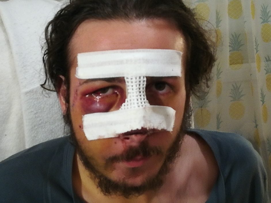 Thomas, grièvement blessé par la police pendant une manif «gilets ...