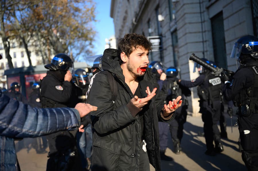 Arthur Naciri en sang après son passage à tabac par des policiers à Lyon le 10 décembre. ©Bastien Doudaine