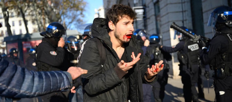 À Lyon, des policiers renvoyés en correctionnelle pour le passage à tabac d’Arthur Naciri