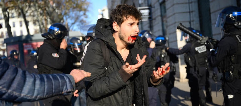 Violences : après le témoignage d’Arthur sur Rue89Lyon, une enquête confiée à l’IGPN