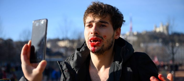 Arthur, 23 ans : « Des policiers m’ont cassé la gueule, littéralement »