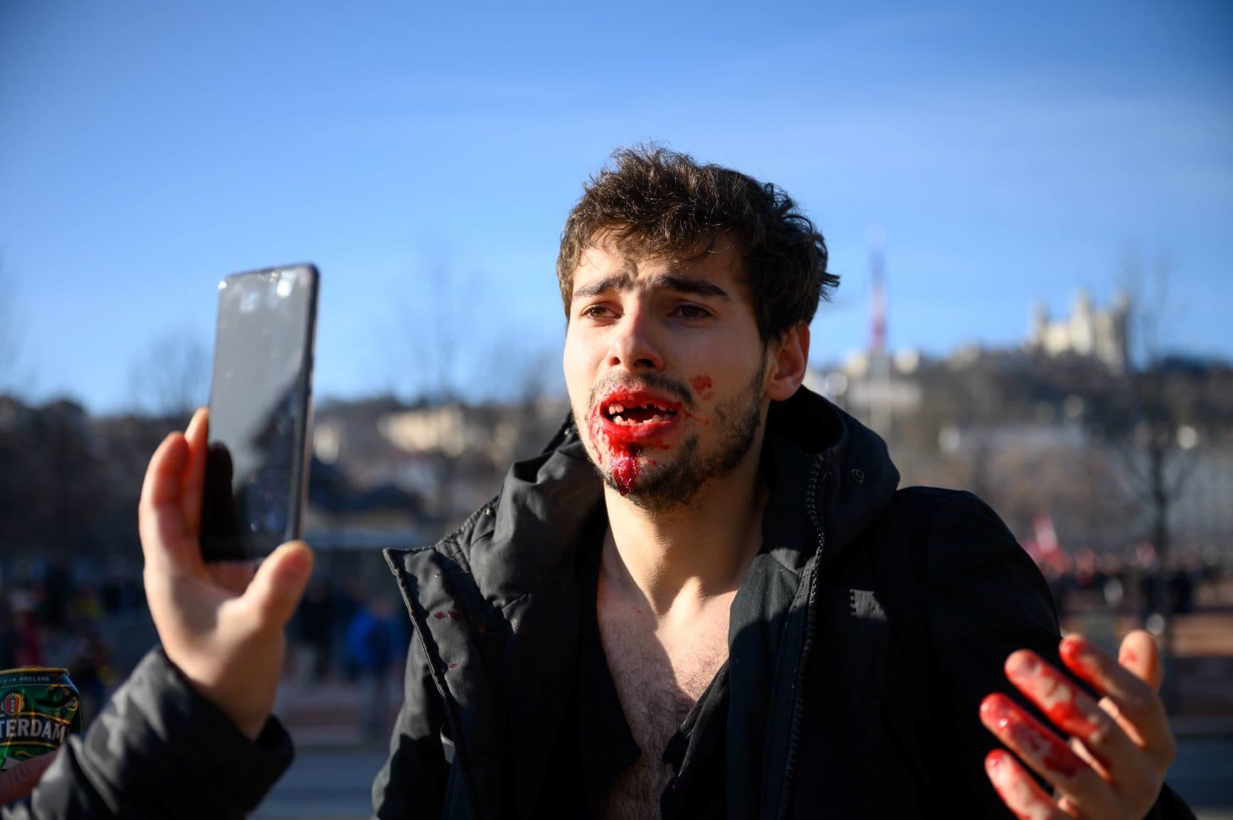 Arthur Naciri, quelques minutes après avoir été passé à tabac par des CRS place Bellecour. Crédit : Bastien Doudaine.