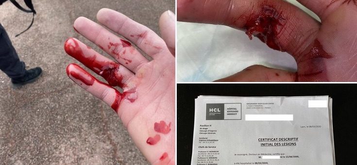 Violences policières lors de l’Acte 69 des « gilets jaunes » à Lyon : « ça a été une journée atroce »