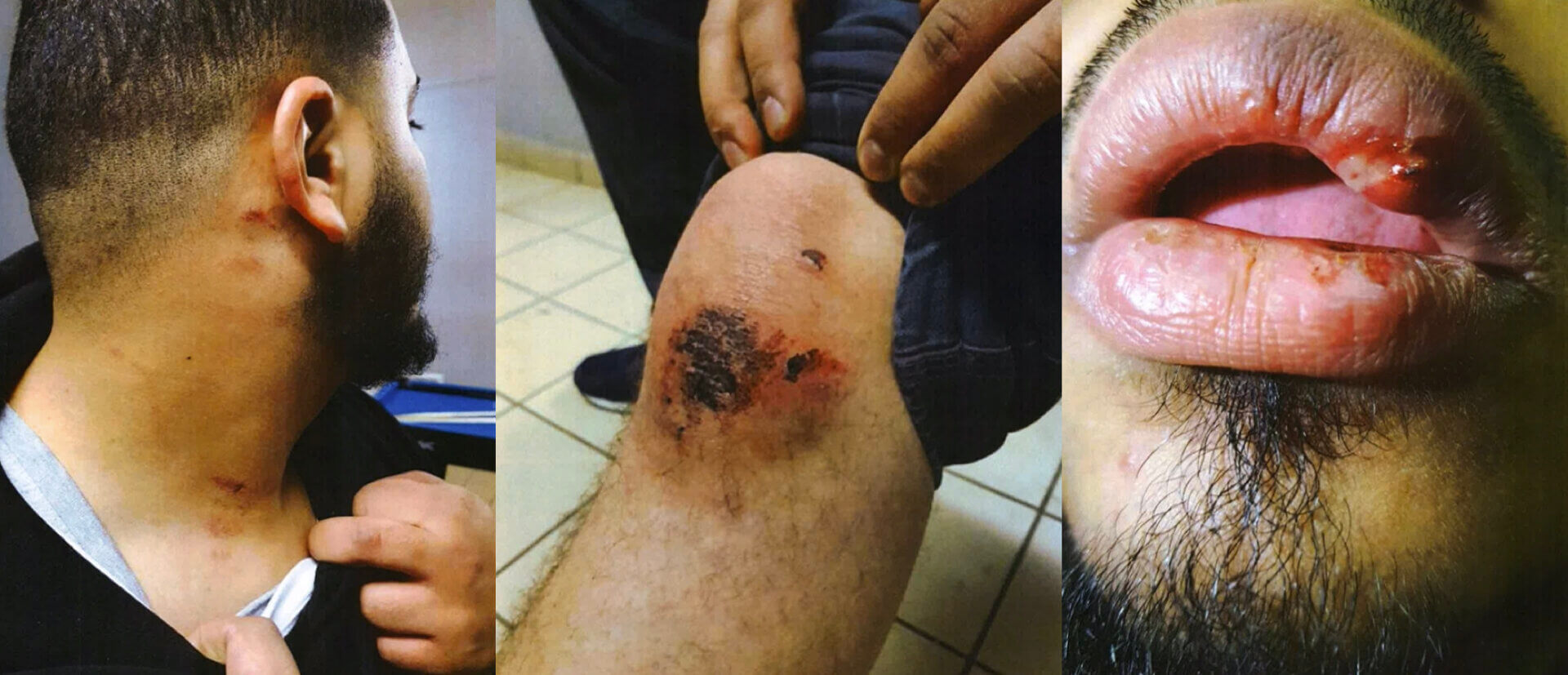 Naïm violences policières Vaulx en Velin