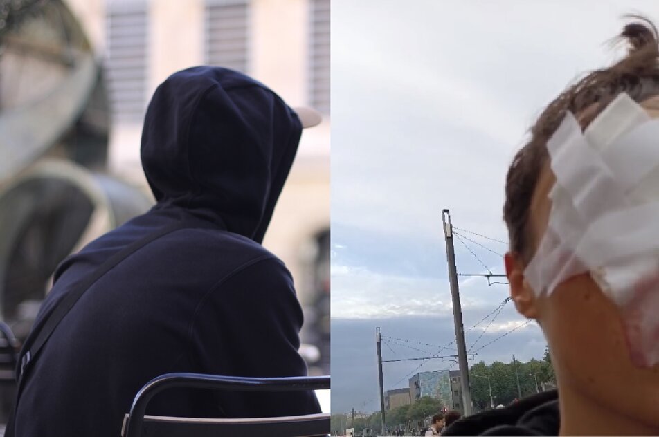 Aldo, 16 ans, blessé à l’oeil lors du blocus d’un lycée de Lyon 8e