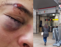Clément, 18 ans, a été roué de coup par des militants d'extrême droite dans le Vieux Lyon. DR
